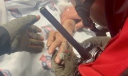 Kahramanmaraş’ta Parmağına Sıkışan Yüzük İtfaiye Ekiplerince Çıkarıldı