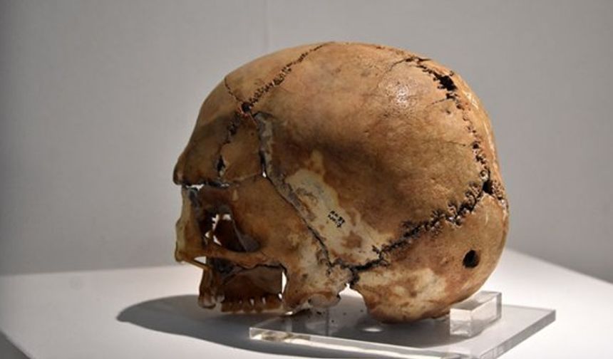 10 bin yıl önce ilk beyin ameliyatı yapılan kafatası yoğun ilgi çekiyor!
