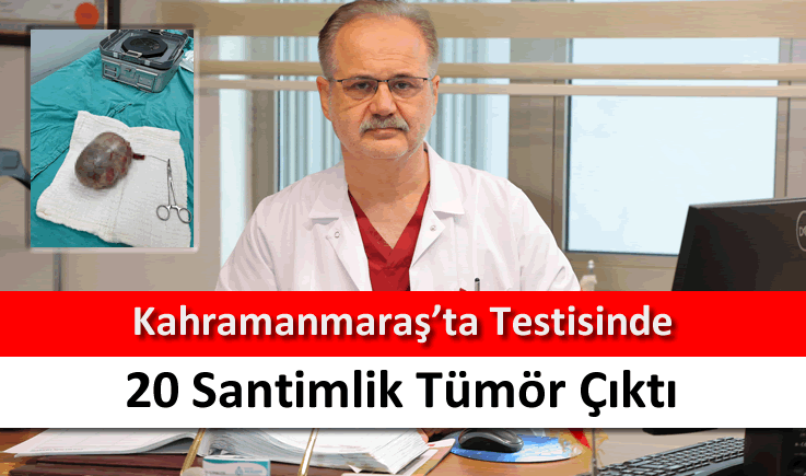 Kahramanmaraş'ta testisinde 20 santimlik tümör çıktı