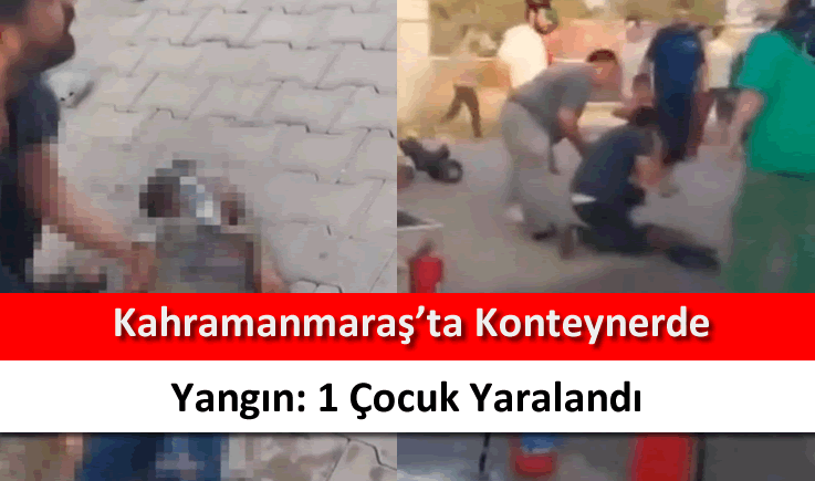 Kahramanmaraş’ta konteynerde yangın: 1 çocuk yaralandı