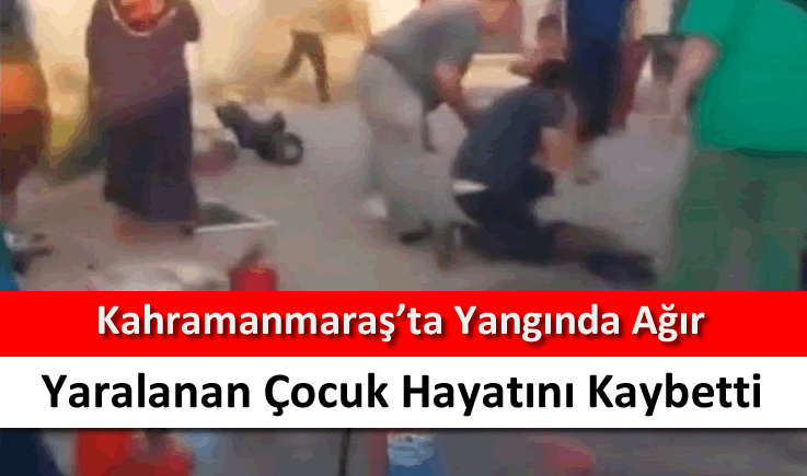 Kahramanmaraş'ta yangında ağır yaralanan çocuk hayatını kaybetti